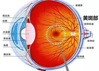 黃斑變性是怎么回事？黃斑變性的方法？